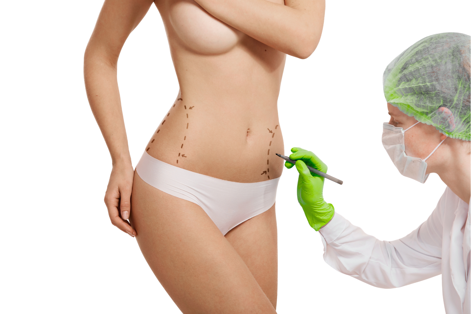 A clinician marking the abdomen for a liposuction assessment